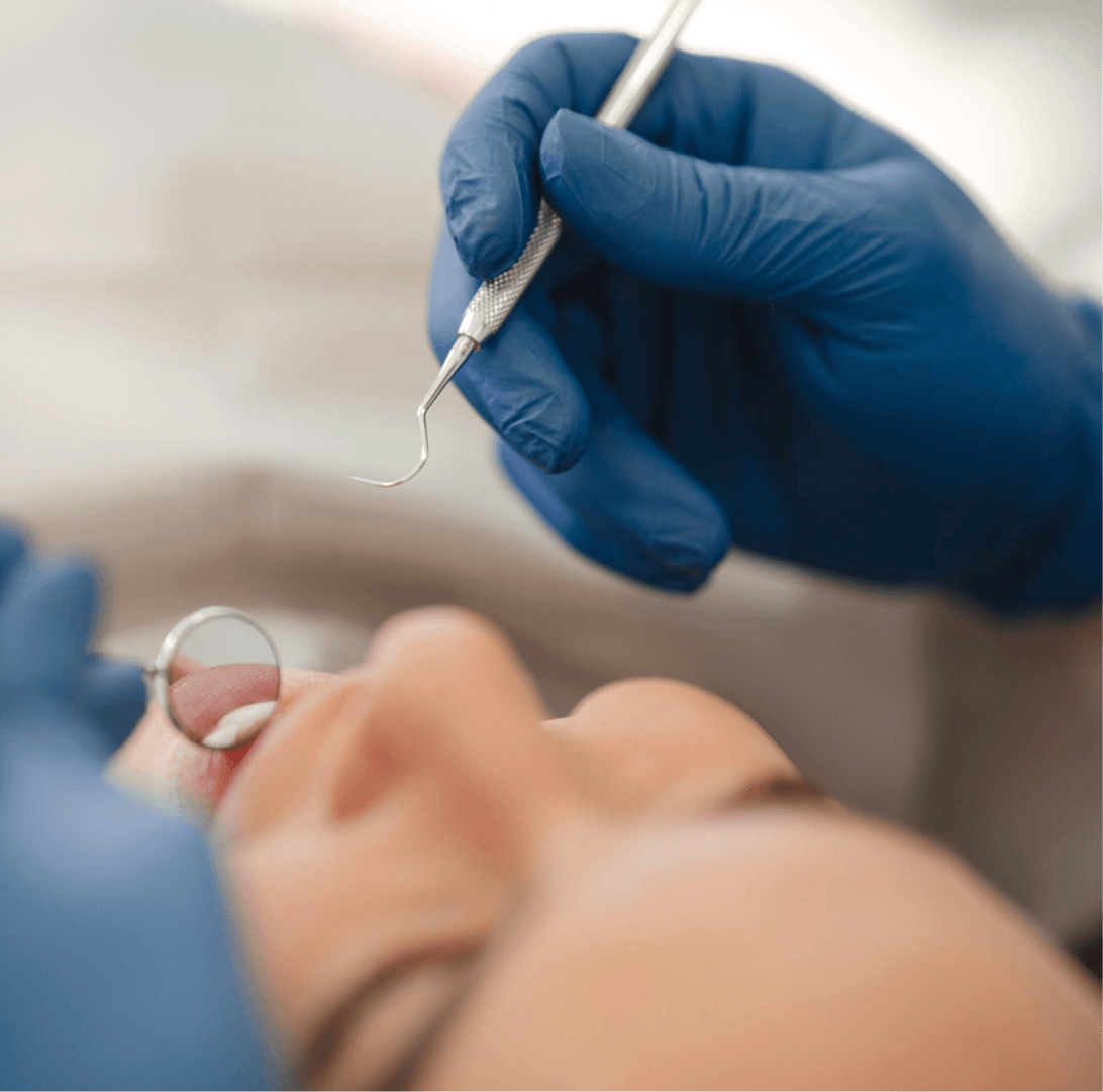 White dental fillings for teeth